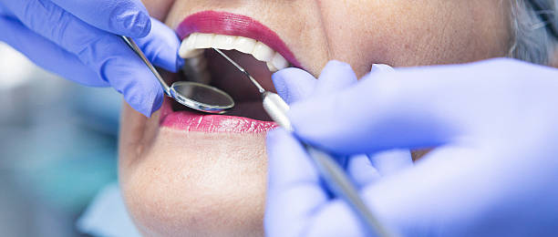 Best Broken or Chipped Tooth Repair in West Lafayette, IN